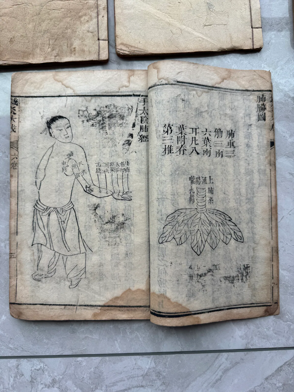 图片展示的是《针灸大成》内页。左侧画面中，一位身着长袍的男子正向左侧伸出手，手掌向上，似乎在进行某种操作。右侧画面呈现了人体的经络图，图中有“手太阴肺经”字样。画面右上角有“针灸大成”字样。该图片与上下文紧密相关，直观呈现了《针灸大成》中关于针灸操作和经络图的内容，与上文提到的针灸术语和经络知识相呼应。