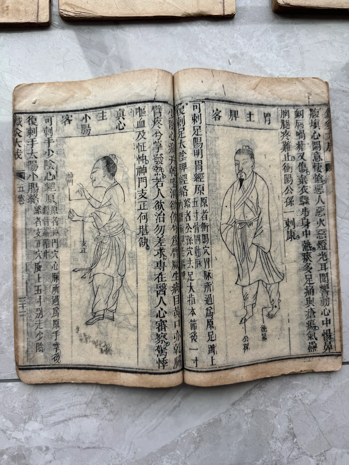 图片展示的是《针灸大成》内页，左侧有两幅人物图，右侧是密密麻麻的穴位名、经络图及“补泻”“迎随”“提插捻转”等术语。左侧人物图上方标注“客脾主胃”，下方有“大肠”“小肠”等字样。右侧图中人物手部有穴位标注，如“大肠”“小肠”等。该图片与上下文紧密相关，直观呈现了《针灸大成》中关于针灸穴位、经络及行针讲究等内容。