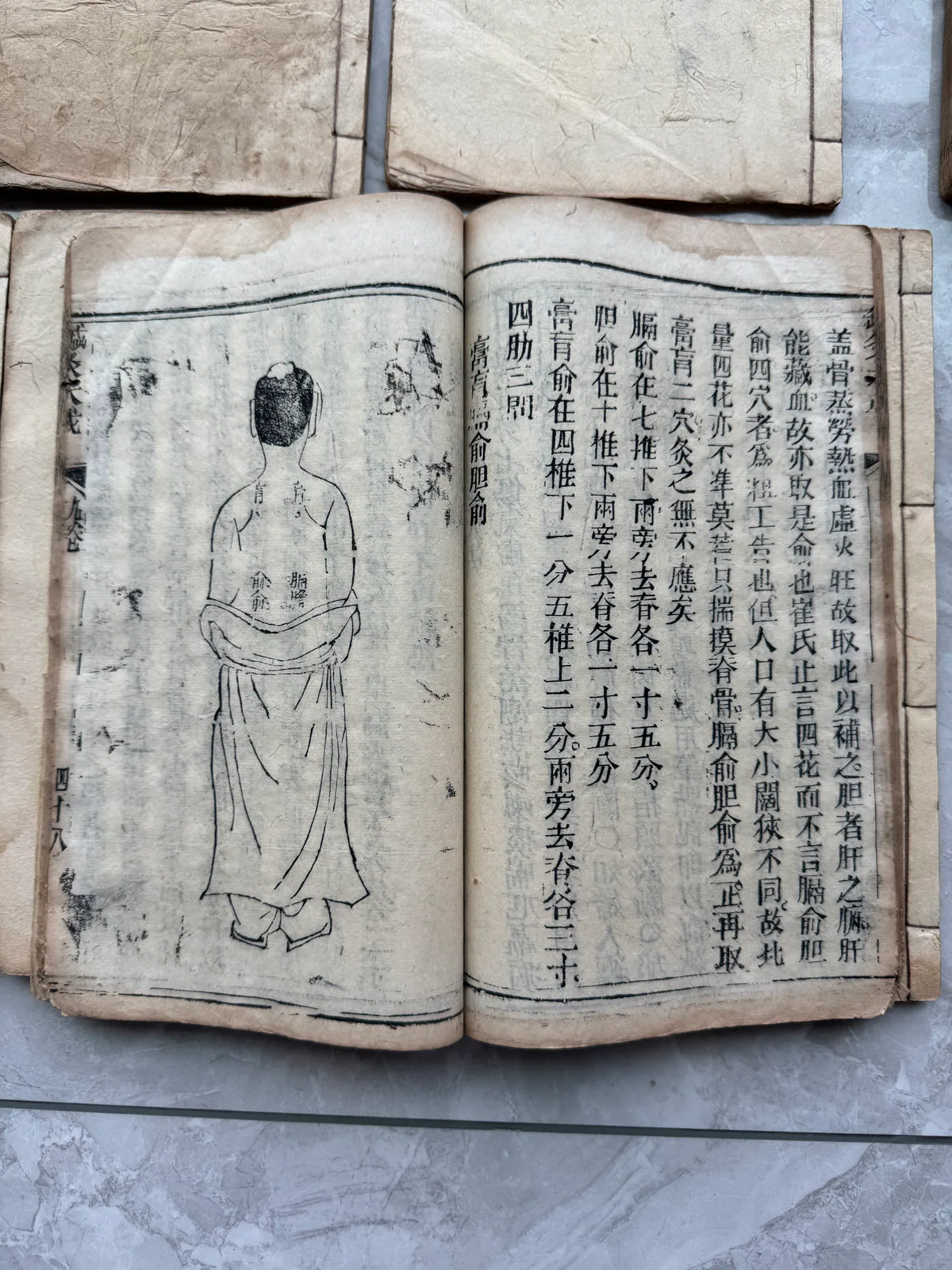 图片展示了一本古旧的《针灸大成》书籍，书页泛黄，部分书页破损。书中有文字记载和人体经络图，经络图以线条描绘人体经络走向，图中人物穿着长袍，头戴帽子。该图片与上下文紧密相关，上下文介绍了《针灸大成》是一部被反复翻阅的“总册”，图片直观呈现了书中内容，体现了其作为针灸学重要文献的实用性和历史价值。